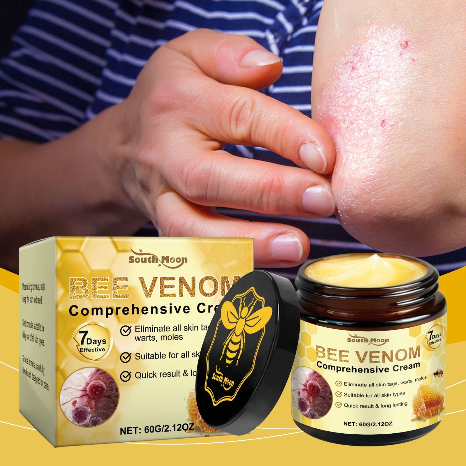 SOUTH MOON bee venom skin nursing cream gentle nourish skin dry discomfort body nursing cream