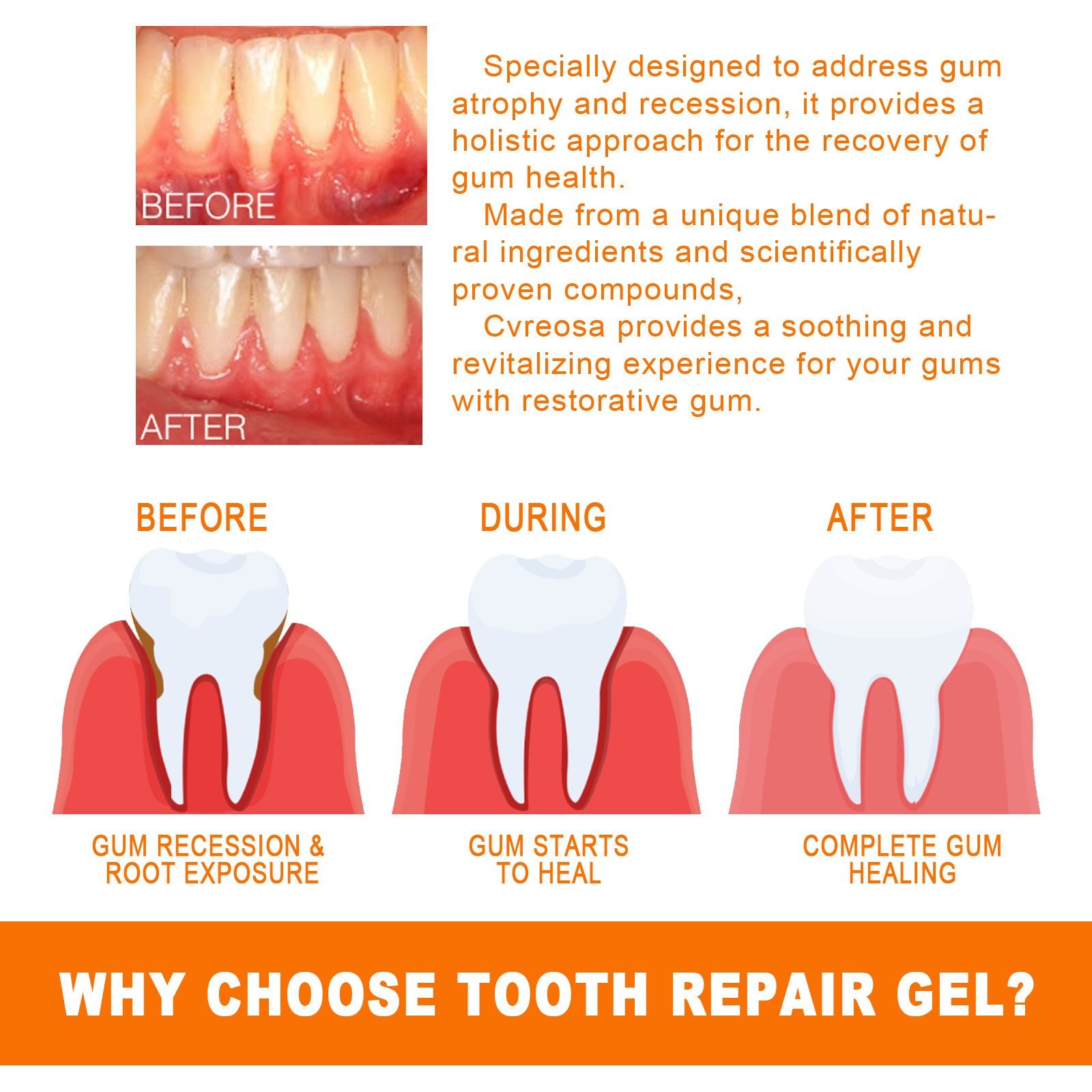 EELHOE tooth repair essence deep clean yellow teeth Tooth stains dental plaque nurture gum oral cavity nursing essence