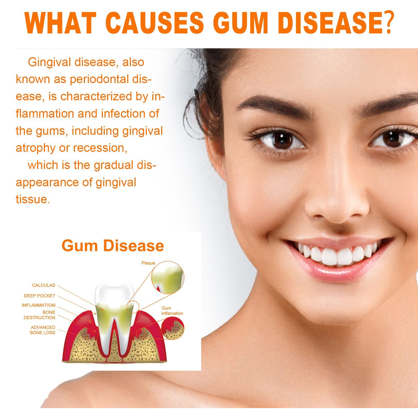EELHOE tooth repair essence deep clean yellow teeth Tooth stains dental plaque nurture gum oral cavity nursing essence