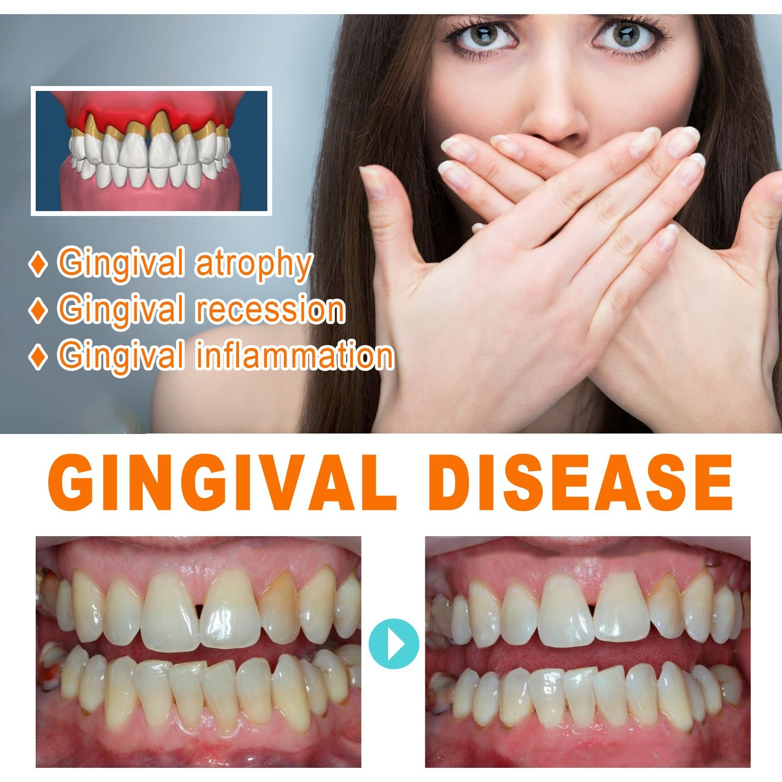 EELHOE tooth repair essence deep clean yellow teeth Tooth stains dental plaque nurture gum oral cavity nursing essence