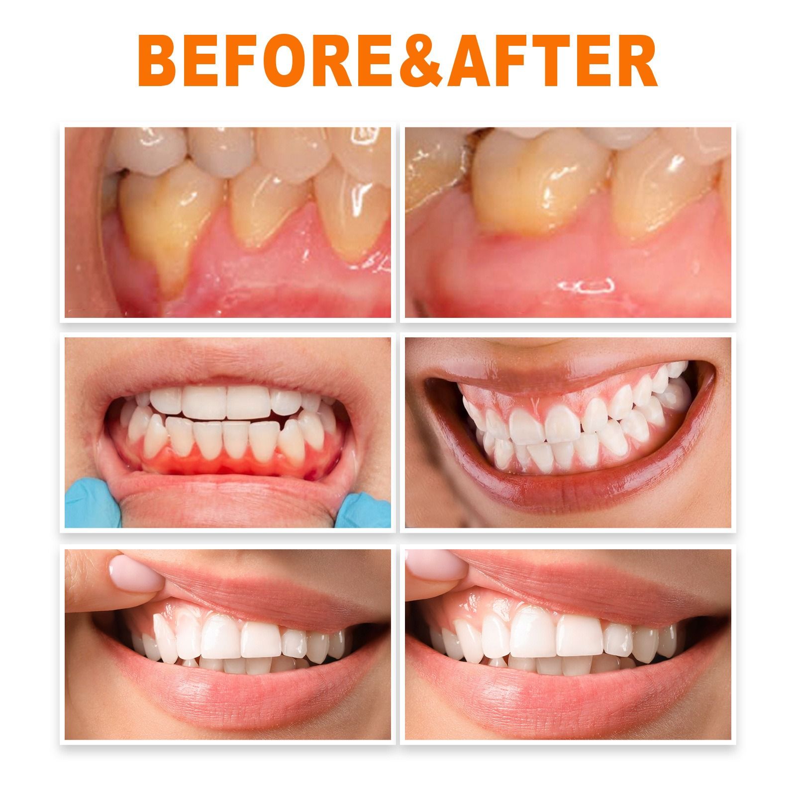 EELHOE tooth repair essence deep clean yellow teeth Tooth stains dental plaque nurture gum oral cavity nursing essence