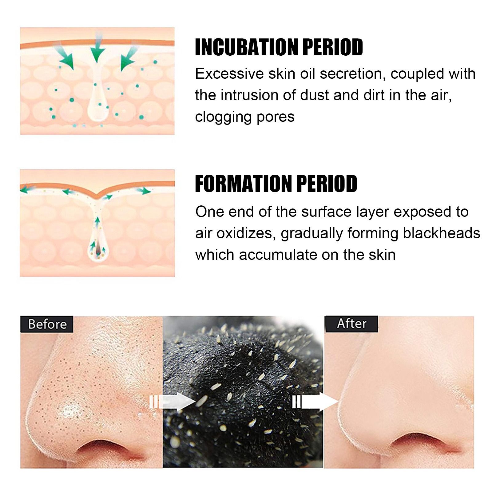 EELHOE nose strip bamboo charcoal remove blackheads Eliminate acne clean pore adsorption grease dirt nose film nose strip