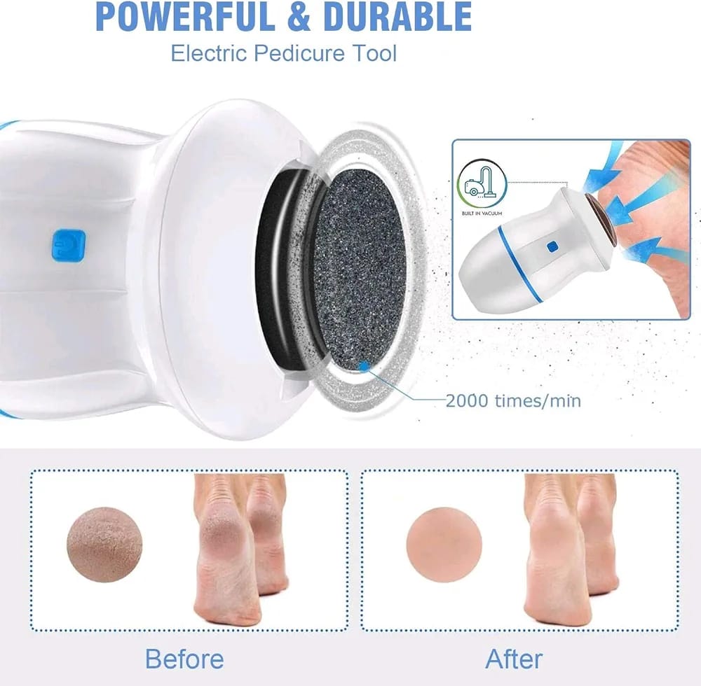 Electric Foot Grinder Vacuum Callus Remover Foot Pedicure Tools Rechargeable Foot Files Clean Tools for Hard Cracked Skin