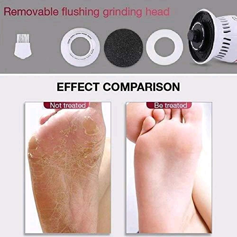 Electric Foot Grinder Vacuum Callus Remover Foot Pedicure Tools Rechargeable Foot Files Clean Tools for Hard Cracked Skin