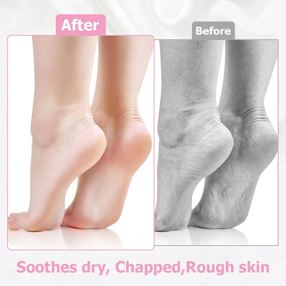 Silicone Foot Care Socks Anti Cracking Moisturizing Gel Socks Dead Skin Remover Protector Pain Relief Foot Care Tool