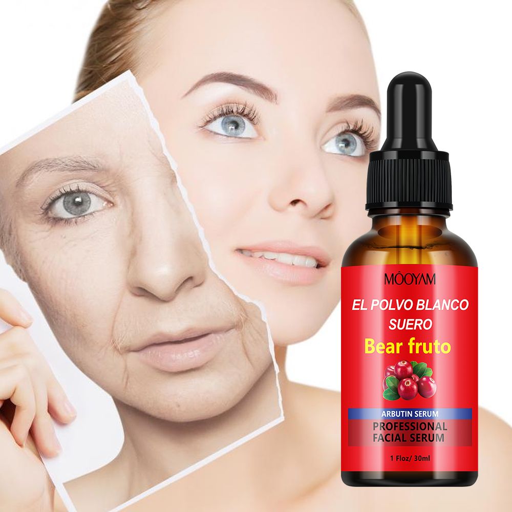 Sadoer 5 in 1 Pack, Pomegranate Serum + Vitamin C Serum + Salicylic Acid Acne Serum + Turmeric  Serum Tumeric + Arbutin Serum Super Antioxidant The set gives Moisturized Skin, Eliminate Acne,