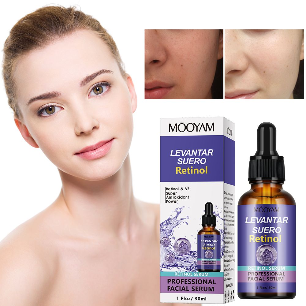 5 Pieces,  Salicylic Acid Acne Essence + Mooyam Retinol Firming Serum+ Vitamin C Face Brightening  + Hyaluronic Acid + Arbutin Rejuvenating  Essence, Skin Brightening, Moisturizing, Anti Wrinkles,