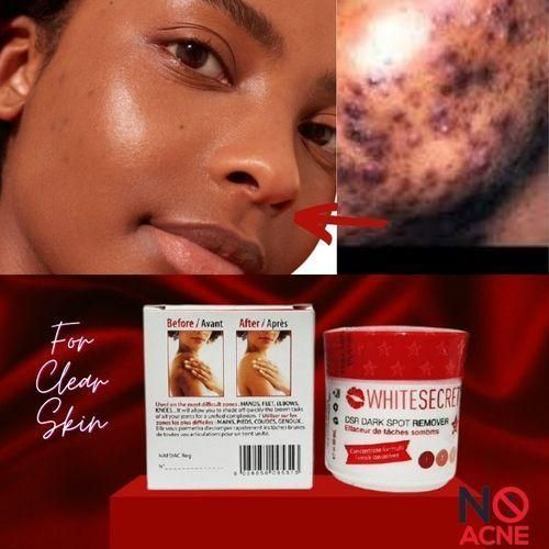 White Secret Dark/Black Spot/Acne Scars Remover/Dark Knuckle,Knees&Elbows