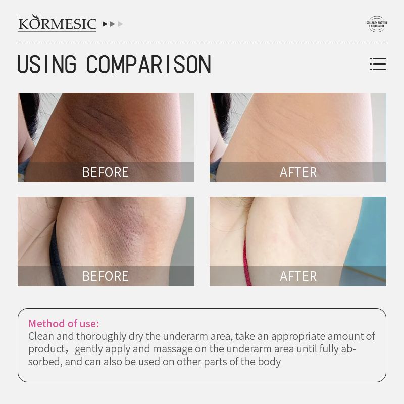 KORMESIC Underarm Brightening Cream with Collagen & Kojic Acid | Moisturize, Repair & Even Skin Tone Revitalizing Underarm Cream Brighten Dark Underarms & Soothe Dryness with Collagen & Kojic Acid