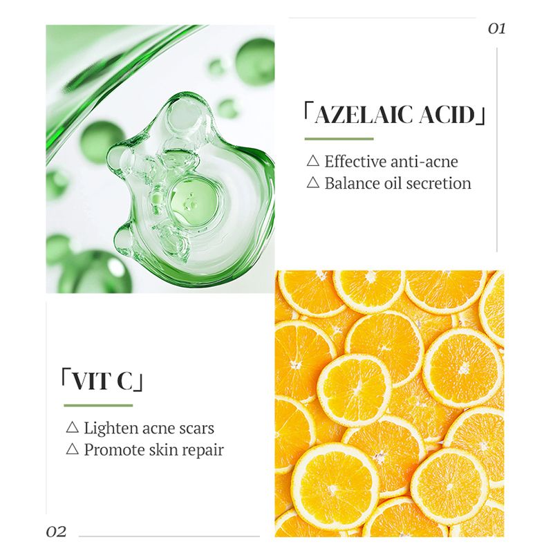 KORMESIC Anti-Acne Facial Cleanser with Azelaic Acid, Niacinamide & Malic Acid | Oil Control & Pore Refining For Oily, Acne-Prone Skin to Minimize Pores & Fade Scars