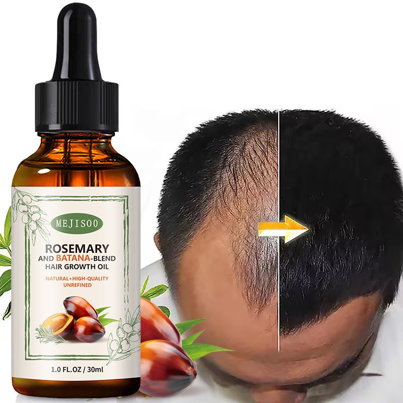BATANA-BLEND HAIR GROWTH OIL BATANA HAIR CONDITIONER Promote hair growth Enhance hair texture Reduce hair split ends