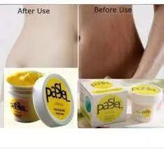 Pasjel Cream For Stretch Marks And Scar Removal Powerful To Stretch Marks Maternity Skin Body Repair Cream 50g