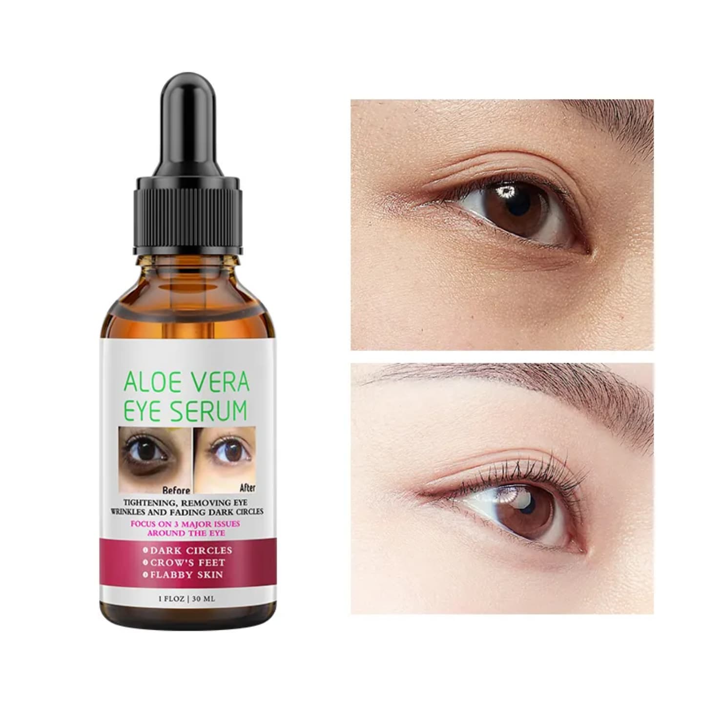 New arrival Dark circle removal aloe vera eye serum anti-puffiness anti-wrinkle moisturizer nourishing 30ml eye serum reduce the visibility of dark circles and give your under-eye area smoother