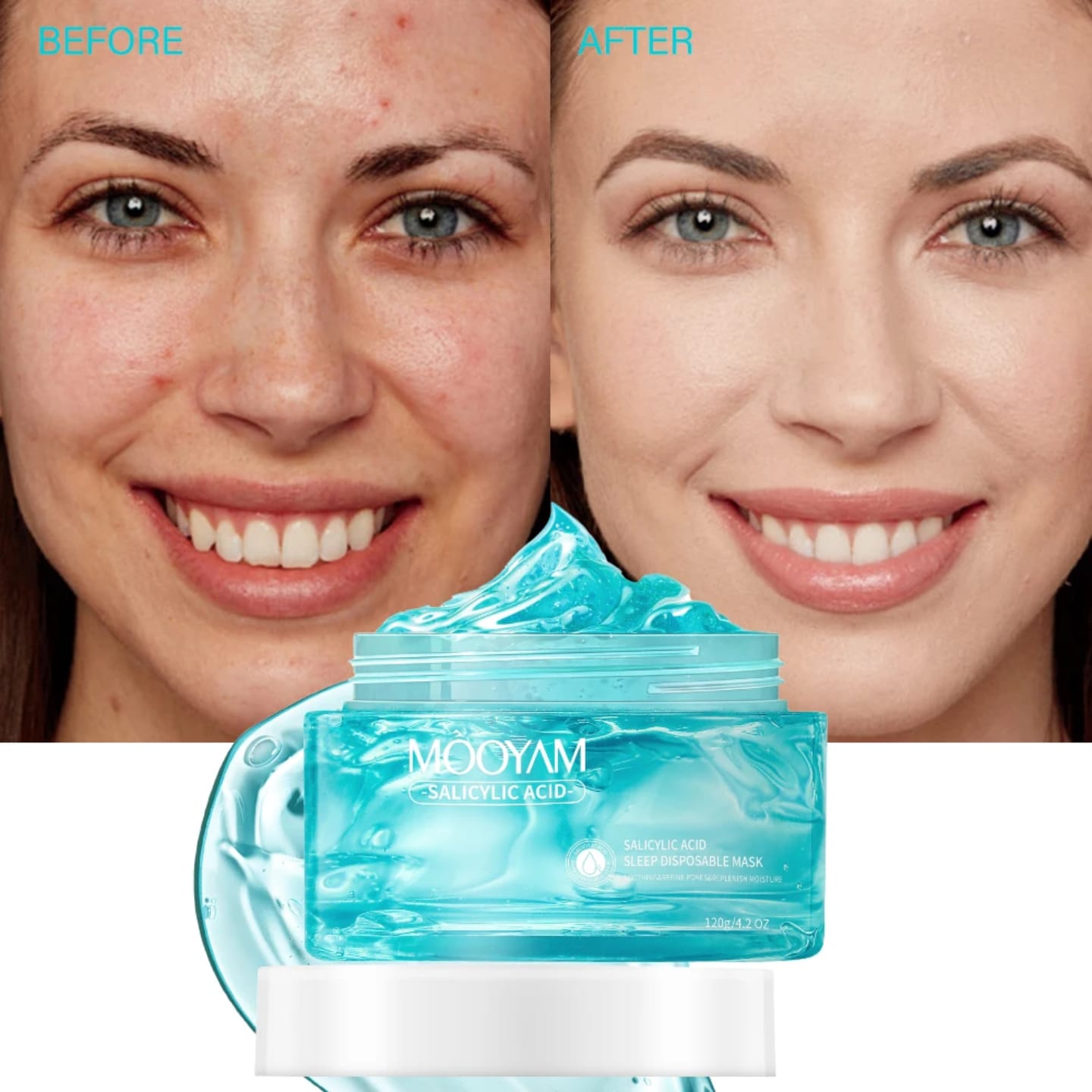 Mooyam Salicylic Acid Sleep Mask 120g Overnight Gel-Based Facial Treatment for Hydration, Exfoliation & Clear, Translucent  glass Skin Deeply Nourishes & Soothes All Skin Types