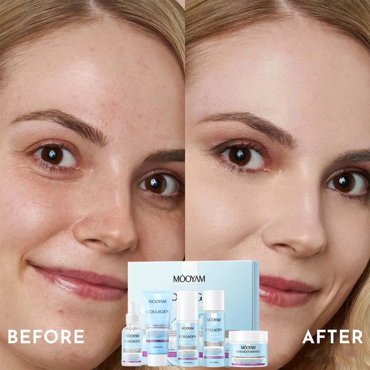 HYDROLYZED COLLAGEN FIRMING SKINCARE SET – 5-PIECE ANTI-AGING KIT FOR WRINKLES, ELASTICITY & YOUTHFUL RADIANCE (CLEANSER, TONER, SERUM, LOTION + CREAM)