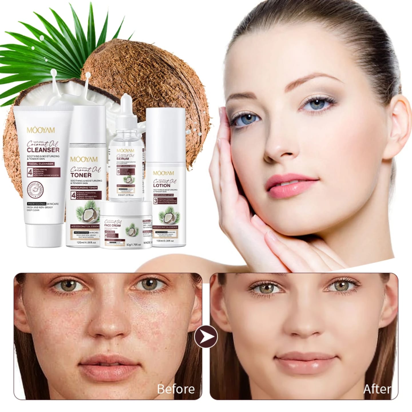 Mooyam Coconut Oil Skincare Set – Complete 5-Step Facial Care