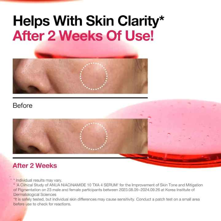 ANUA Niacinamide 10 + TXA 4 Serum, Hyaluronic Acid, Tranexamic acid, Vitamin B12, Facial Serum for Glass Skin, Clarifying, Radiant Complexion with Natural Color, Korean Skin Care