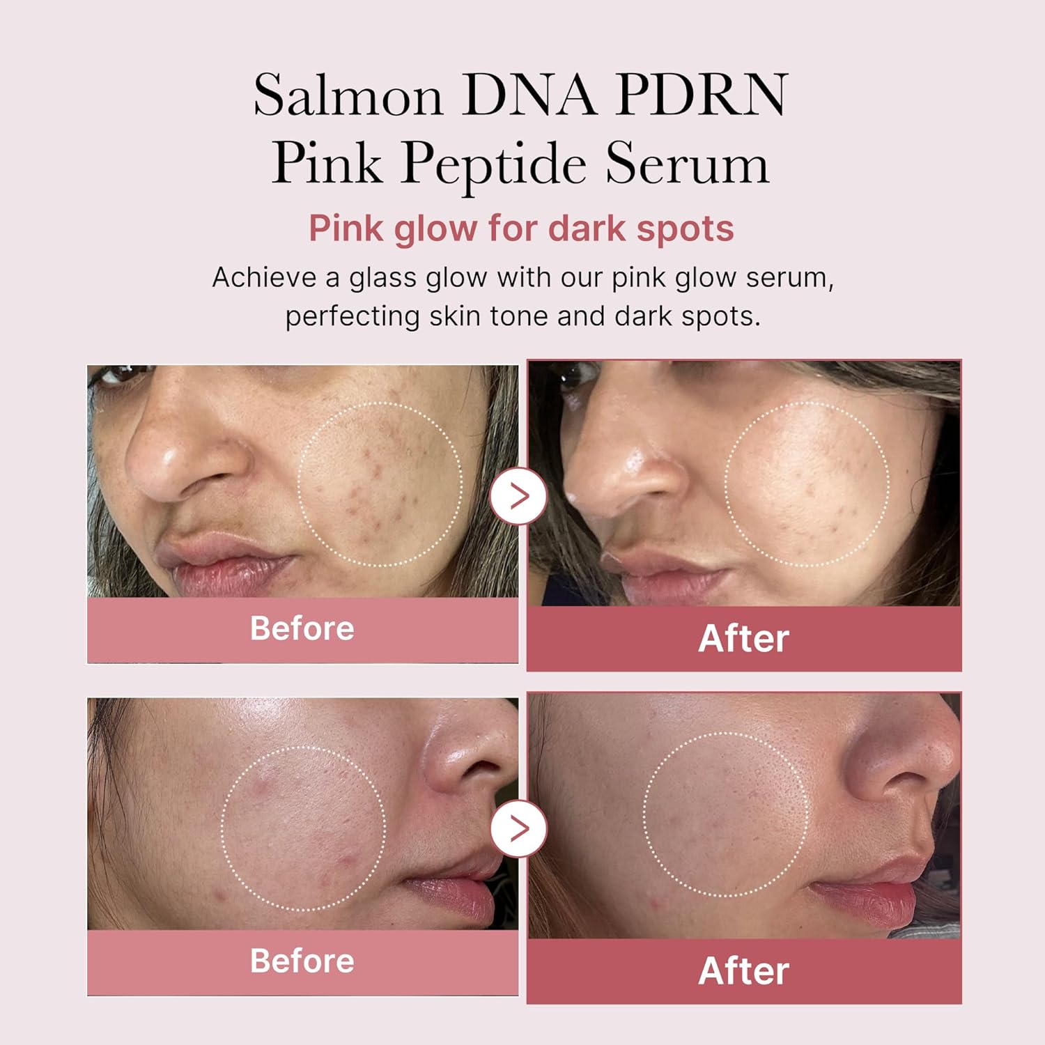 Overnight Renewal Salmon PDRN Duo: Salmon DNA PDRN Pink Peptide Serum and Salmon DNA PDRN Pink Collagen Capsule Cream