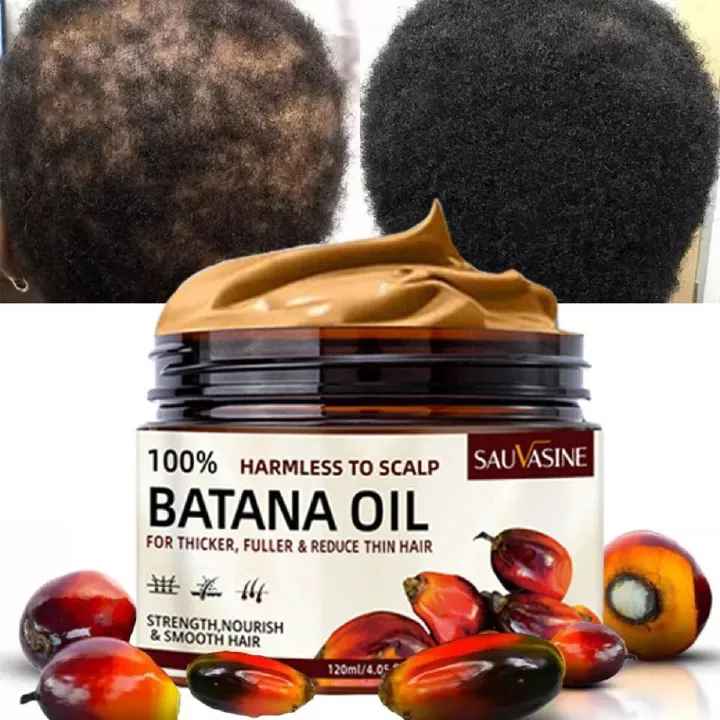 New Arrivals Batana Oil Fast Hair Growth for Women Men Pure Batana Oil Nourish Shiny Hair Healthy Hair Care Anti Hair Loss Hair Growth Care Repair Damaged For Men & Women -