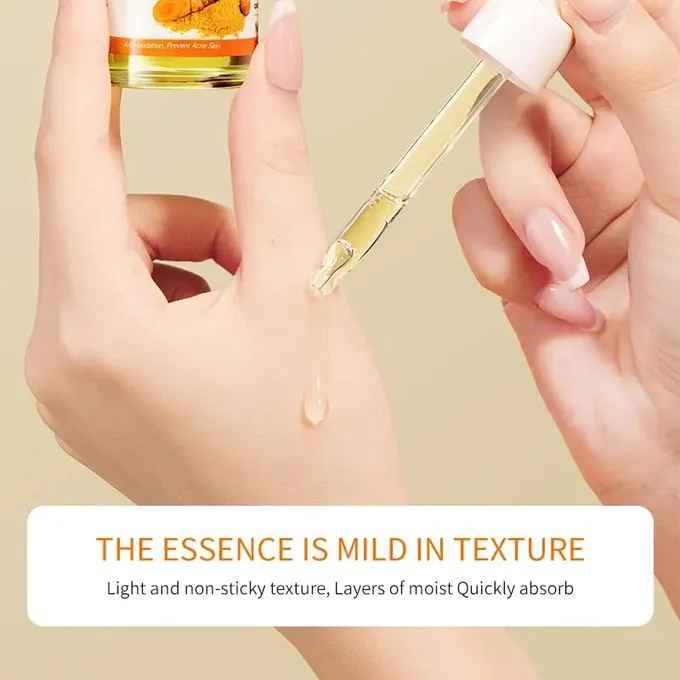 Sadoer Soothing Care, Oil Control Turmeric Serum, Anti Oxidation Acne Removal Tumeric, Effective in Moisturizing Smoothening, Evens Skin Tone, Deep Hydration Akin to Vitamin C in achieving Smooth Skin