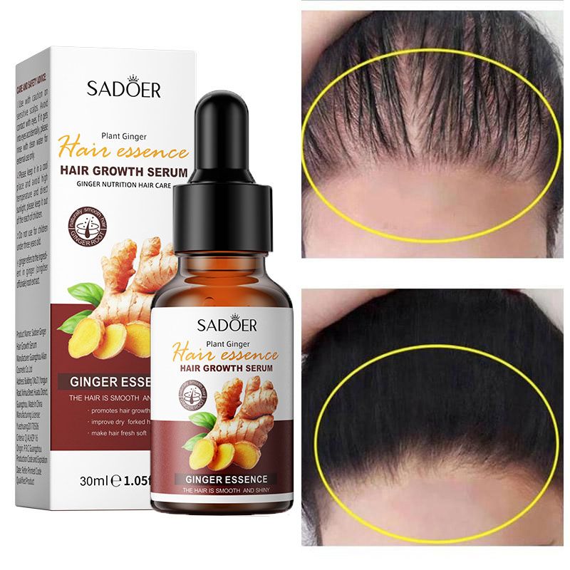Ginger Hair Growth Serum Anti Hair loss Baldness Fast Regrowth Hair Care Oil Repair Damaged Hair Scalp Treatment For Women Men - SADOER-
