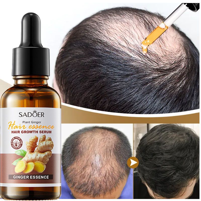 Ginger Hair Growth Serum Anti Hair loss Baldness Fast Regrowth Hair Care Oil Repair Damaged Hair Scalp Treatment For Women Men - SADOER-