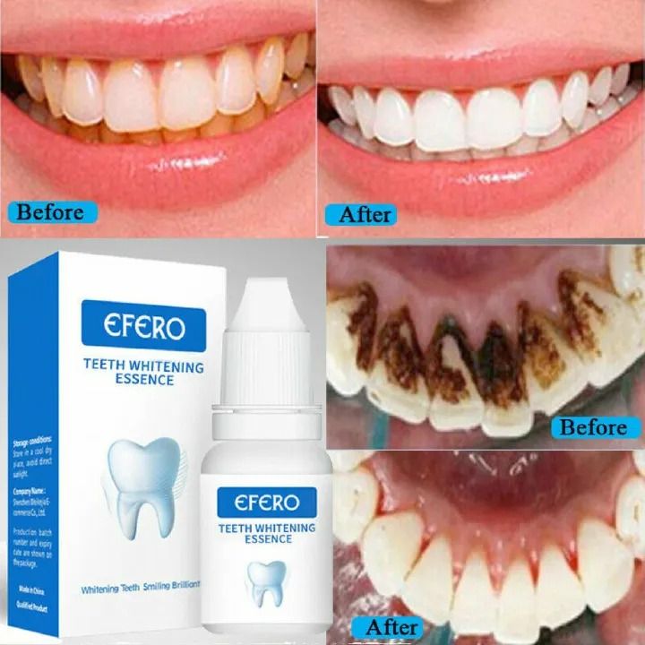 Teeth Whitening Essence Remove Against Dental  Plaque Stains Serum Fresh Breath Oral Hygiene Dental Tooth Cleaning Tools - EFERO-