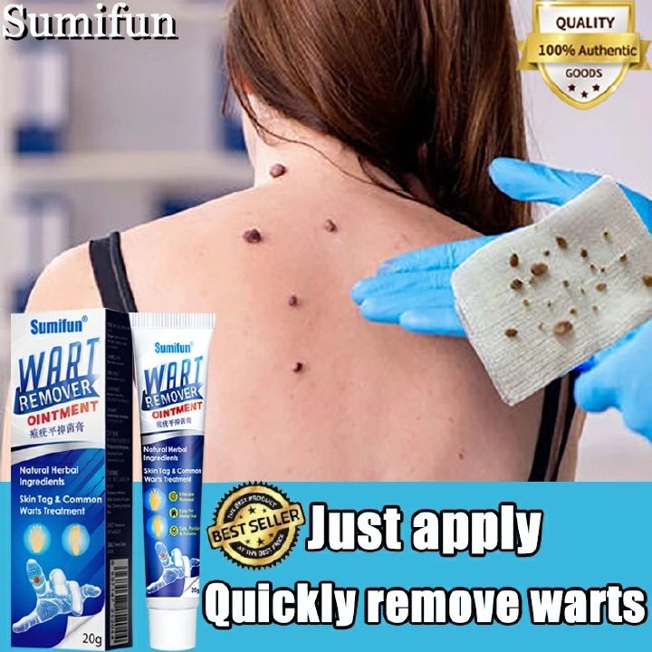 7Days Wart Remover Ointment Herbal Ingredients Natural Safe Body painless Warts Treatment for Acne Moles Scar Warts Off Instant Blemish Removal Cream Wart Remover Ointment for All Skin Types-