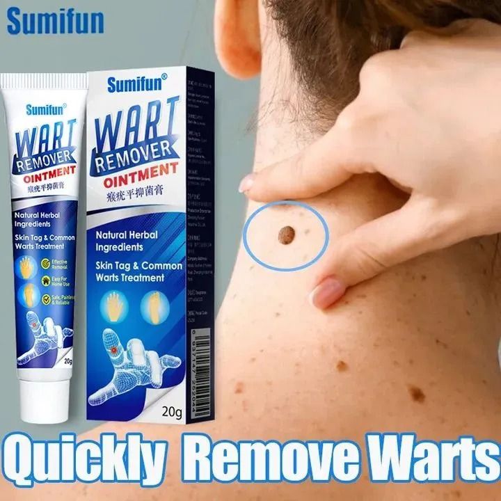 7Days Wart Remover Ointment Herbal Ingredients Natural Safe Body painless Warts Treatment for Acne Moles Scar Warts Off Instant Blemish Removal Cream Wart Remover Ointment for All Skin Types-