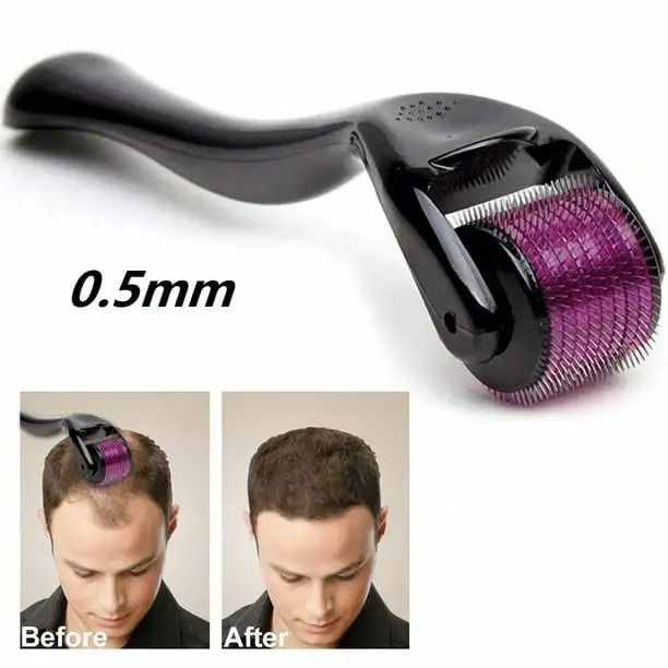 Derma Roller Dermaroller Titanium Hair Regrowth Beard Growth Anti Hair Loss Treatment Professional Microneedling Face Massage Roller for Face Beard Growth Hair Growth 0.5mm Mesotherapy System-