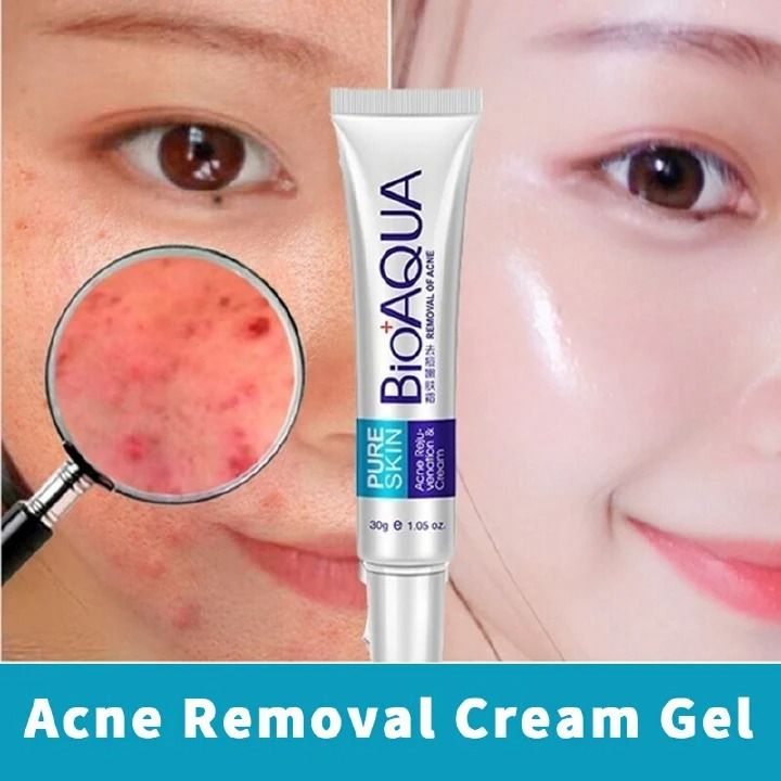 Herbal Acne Face Cream Pimple Scar Remover Gel Oil Control Shrink Pore Pockmark Smooth Acne Marks Facial Cream Skin Care Product - BIOAQUA-