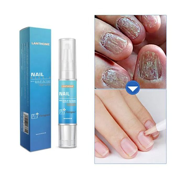 7 Days Nail Fungal Treatment Essence Oil Foot Toe Nail Fungus Removal Serum Repair Onychomycosi Anti Infection Gel Care Products - LANTHOME -