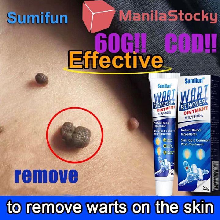 Fast Warts Remover Skin tag Antibacterial Ointment Wart Treatment Cream Original Herbal Extract Corn Plaster Warts Ointment -