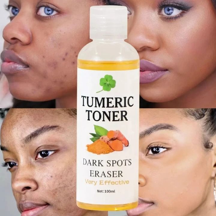 Quick Dark Spots Corrector Serum Tumeric Toner Acne Remover Fade Dark Spots Eraser Skin Care Serum 100ML Toner - MOOYAM - -