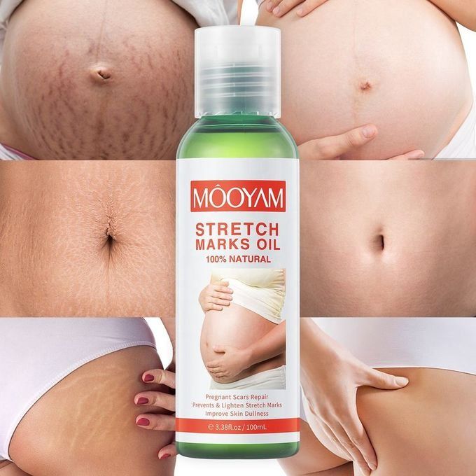 100ML Stretch Mark Removal Oil Belly,Hands,Legs Marks Repairing Pregnancy Obesity Body Marks Removal Scar Moisturizing Repair Anti-Aging Anti-Winkles Cream Increase Skin Elasticity Smooth Firm -MOOYAM