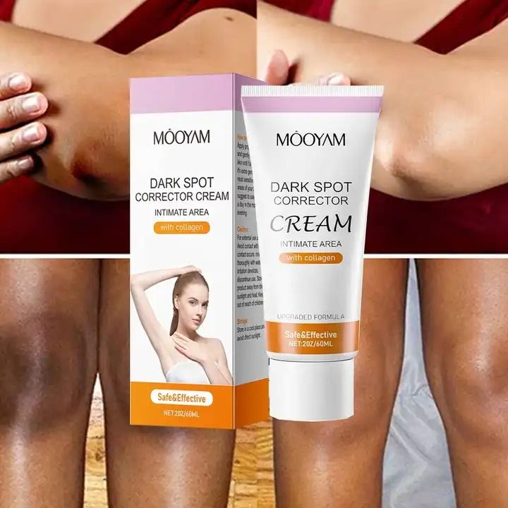 Whitening Cream Lightening Knees Elbows Intimate Areas Underarm Dark Skin Underarm Brightening Cream Inner Thighs Bleach Joint Remove Melanin Cream - MOOYAM
