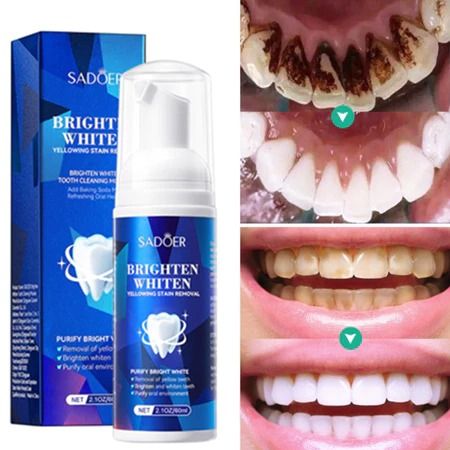 Brown Teeth Whitening Essence Remove Plaque Stains Oral Hygiene Bleaching Products Cleansing Fresh Breath Dentistry Care Tools- SADOER