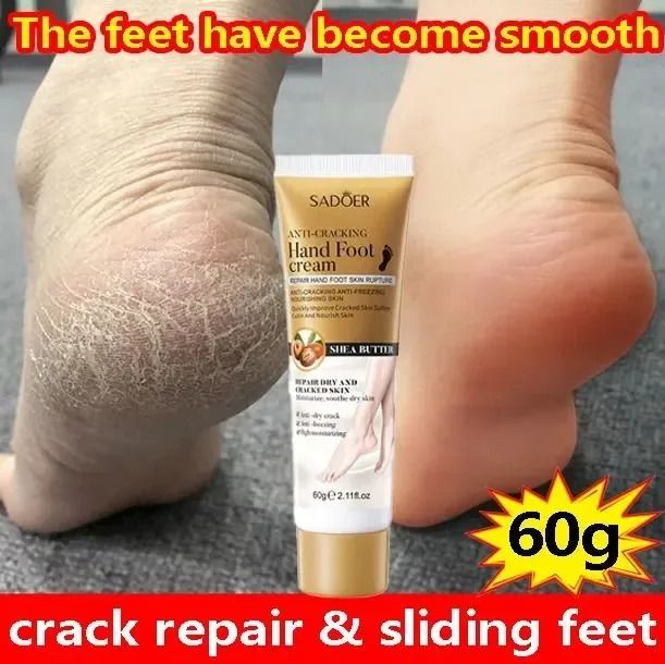 Herbal Anti Crack Foot Cream Heel Cracking Repair Products Exfoliation Dead Skin Removal Softening Rough Dry Moisturize Whiten Skin Care 60g  - SADOER -