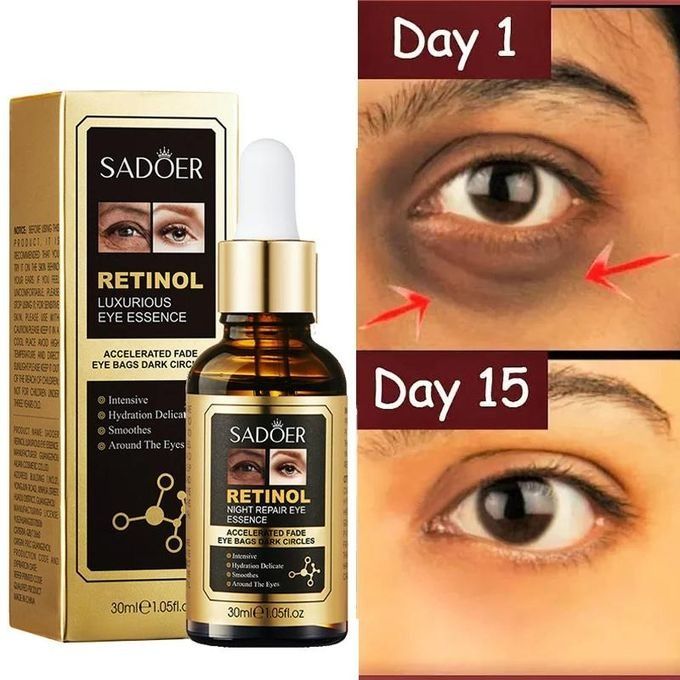 Retinol Eye Serum for Eye Bags Dark Circle Remover Anti-Puffiness Wrinkles Dark Eyebag Removal Serum Anti-Aging Moisturizing Brightening Lifting Face Serum 30ml - SADOER -