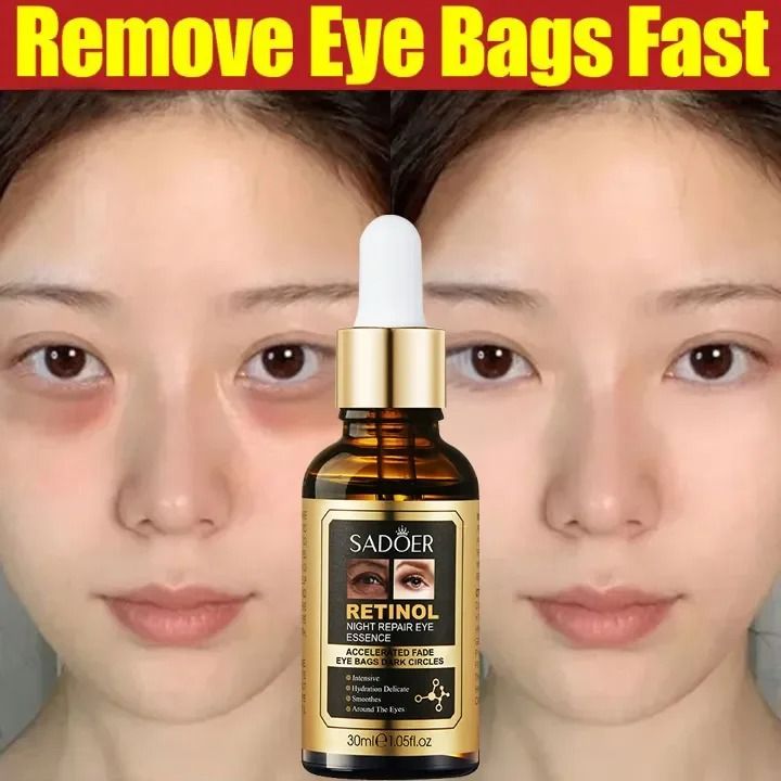 Retinol Eye Serum for Eye Bags Dark Circle Remover Anti-Puffiness Wrinkles Dark Eyebag Removal Serum Anti-Aging Moisturizing Brightening Lifting Face Serum 30ml - SADOER -