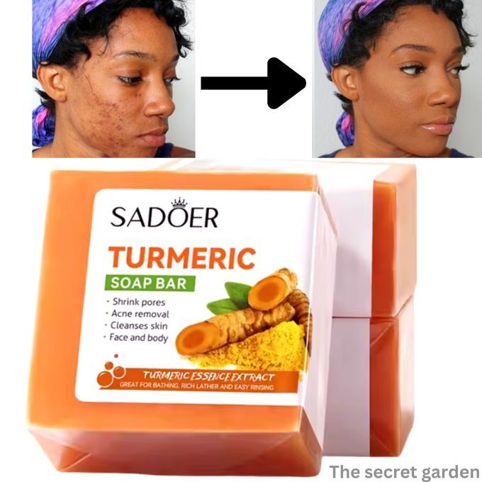 Original Turmeric Soap For Dark Spot Acne Blackheads Skin Whitening Facial Body Hand Make Soap Bar Oil Control Acne Deep Cleaning Ginger Moisturizing - SADOER -