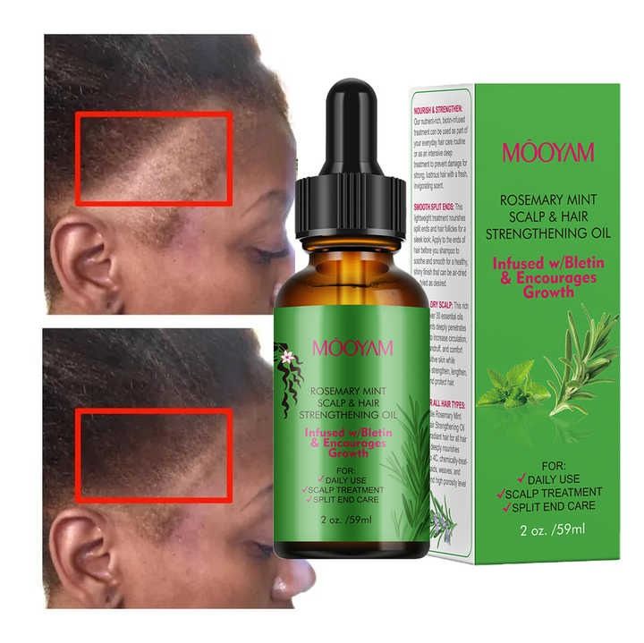 Organic Rosemary Mint Scalp & Hair Strengthening Oil With Biotin & Essential Oils,Hair Growth Multipurpose Rosemary Oil - MOOYAM -