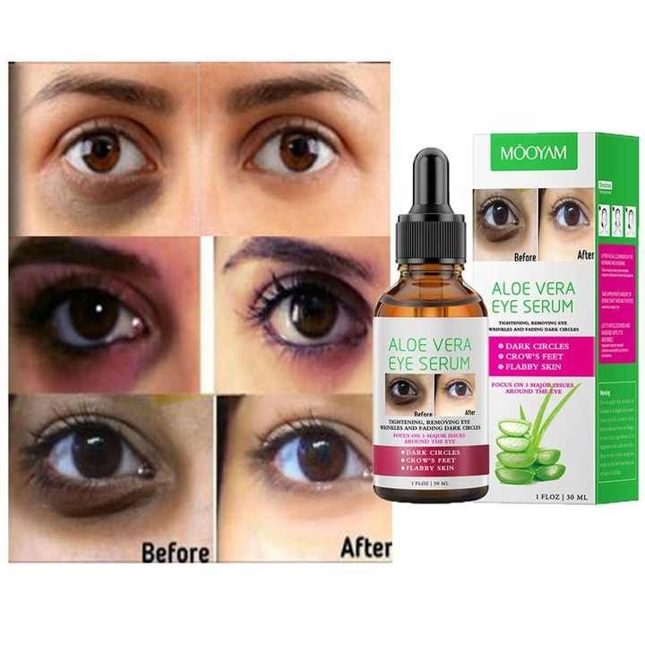Eye Anti Wrinkle Pufiness Dark Circles Remover Aloe Vera Serum Fade Fine Lines Eye Bags Anti-aging Firming Lifting Eye Care Product - MOOYAM -