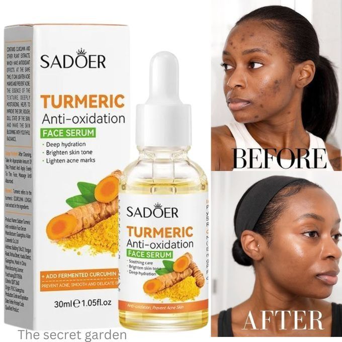 2 in 1,Tumeric Serum + Tumeric Soap Darks Spots Removal, Anti Acnes,Oil Control Face Brightening Blackhead Remover Set Pore Shrinking and Skin Tone Brightening - SADOER -