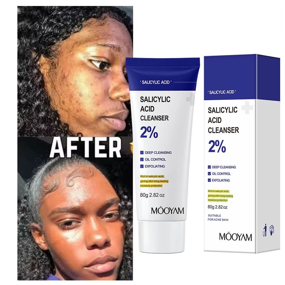 Facial Cleanser Skin Deep Cleansing Salicylic Acid Face Wash Moisturizing Blackhead Removal skincare Face Wash Foam Face Cleanser Skin Care- MOOYAM -