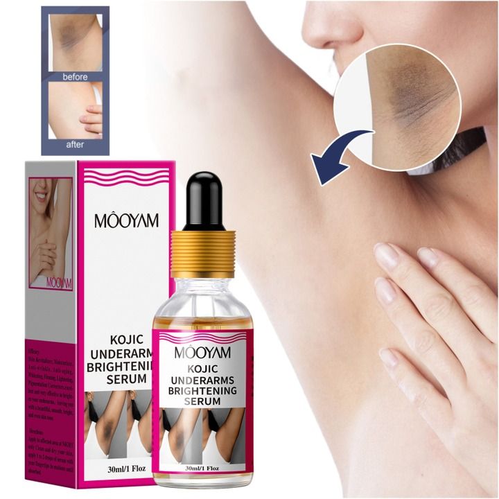 Body Whitening Underarms Armpits Whitening Kojic Acid Serum Bleach Brighten Underarm Elbow Knees Joint Removal Intimate Parts Dark Spots Melanin Snow Bleach Cream 30ml - MOOYAM -