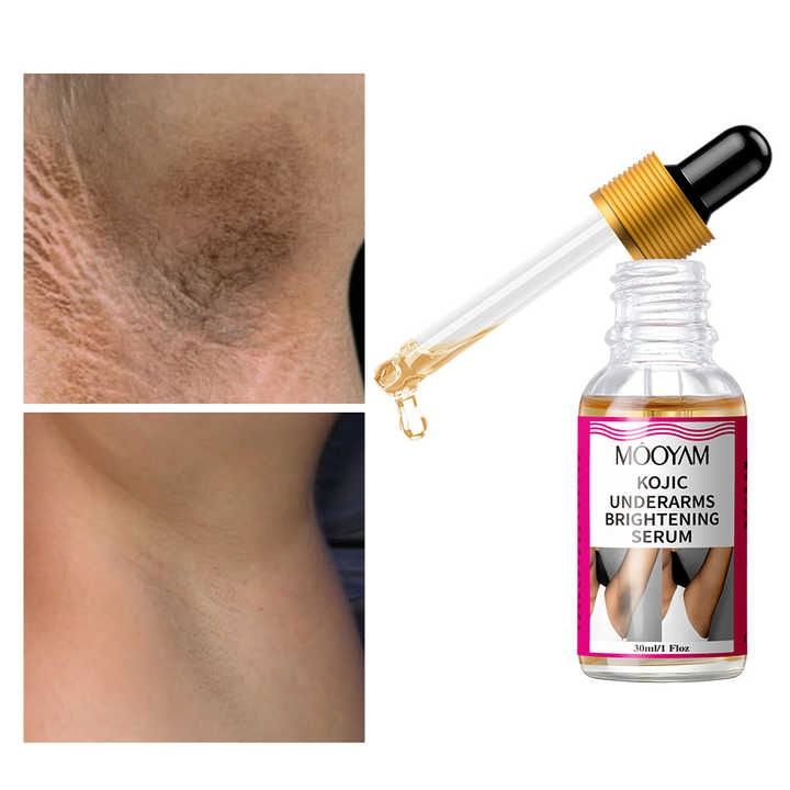 Body Whitening Underarms Armpits Whitening Kojic Acid Serum Bleach Brighten Underarm Elbow Knees Joint Removal Intimate Parts Dark Spots Melanin Snow Bleach Cream 30ml - MOOYAM -