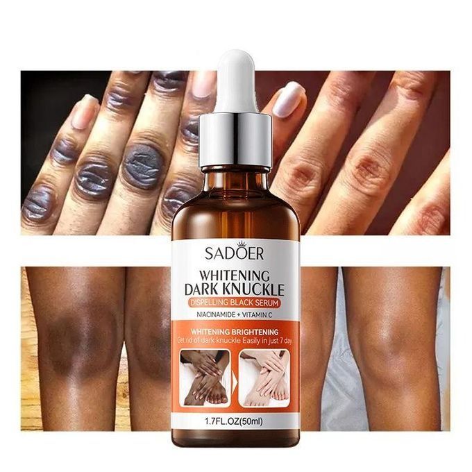 Fast Whitening Dark Knuckles Darks Spots Remover Serum Brighten Hand,Elbows,Knees Soften Moisturize Lighten Melanin Stains Corrector l Intense Stains Remover Products Beauty Care 50ml - SADOER -