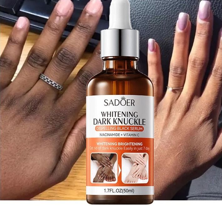 Fast Whitening Dark Knuckles Darks Spots Remover Serum Brighten Hand,Elbows,Knees Soften Moisturize Lighten Melanin Stains Corrector l Intense Stains Remover Products Beauty Care 50ml - SADOER -