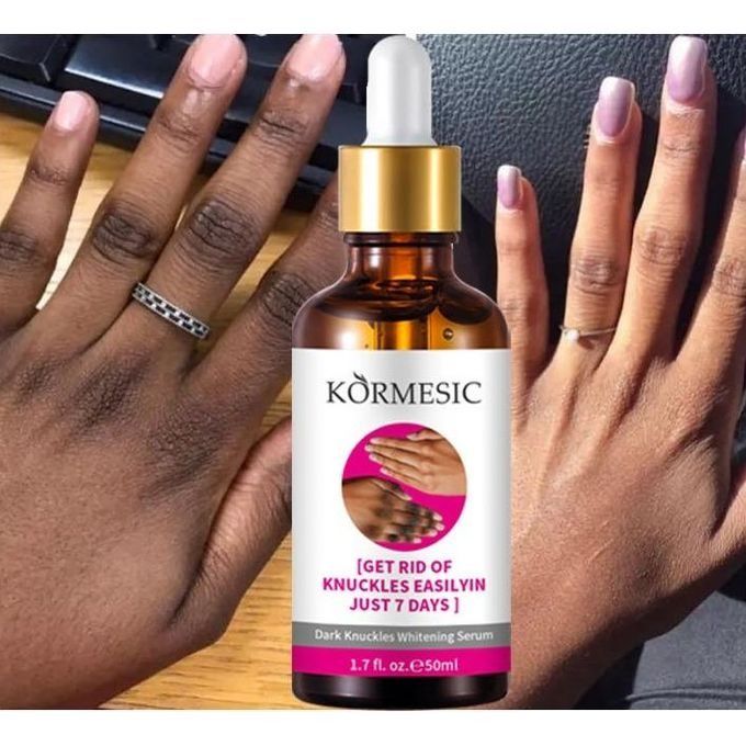 Authentic Strong Whitening Serum for Dark Skin Lightening Lotion for Dark Knuckles, Elbows, Fingers and Inner Thighs - KORMESIC -